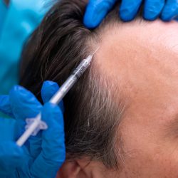 HAIR TRANSPLANTATION 3